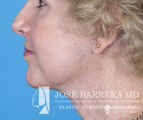 Photo of Jose Barrera, MD, Facial Plastic and Reconstructive Surgeon