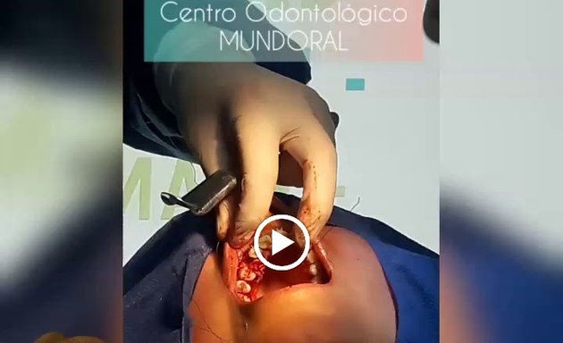 Foto de Mundoral Clinica Dental