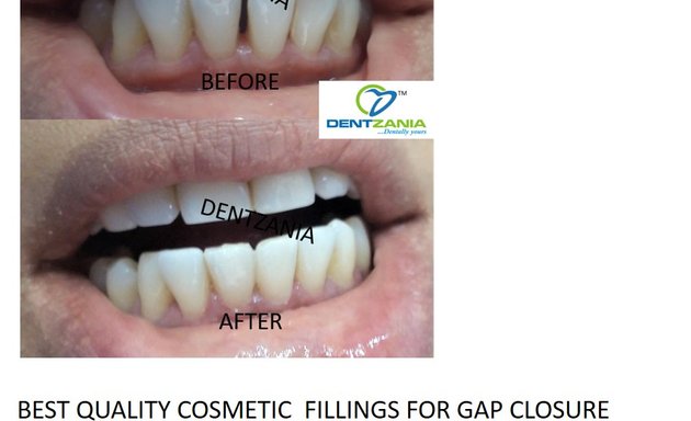 Photo of Dentzaniaᵀᴹ Advanced Multispeciality Dental Care Centre
