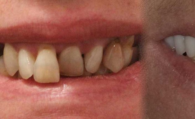 Photo of Shergill Dental Implants