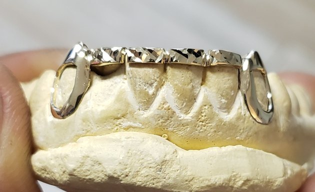 Photo of Mobile Gold Grillz