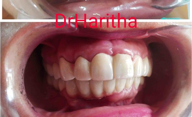 Photo of Dr.Haritha Tooth Align Multi Speciality Dental Clinic and Implant centre and Dentist HSR layout Bangalore