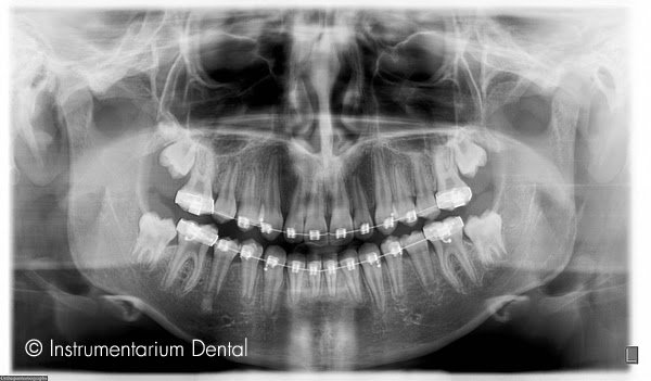 Foto de Radiografías Dentales - 3DRay El Llano