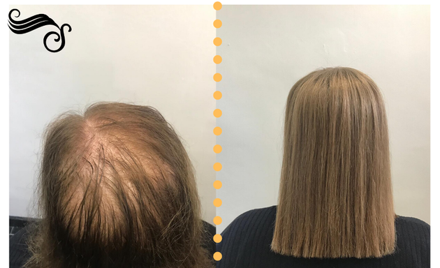 Photo of UltraStrands Hair Integration Systems