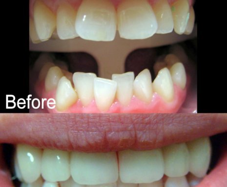 Photo of ADCC Dental Calamvale