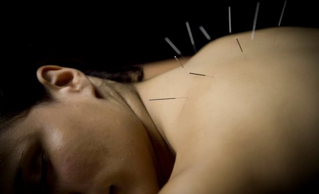 Photo of AJM Acupuncture