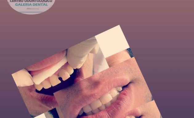 Foto de Centro Odontologico Galería Dental