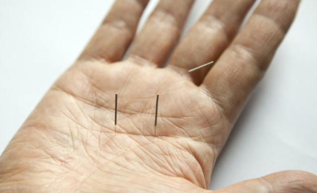 Photo of Anmian Acupuncture
