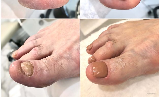 Photo of Nails by Toe Bro