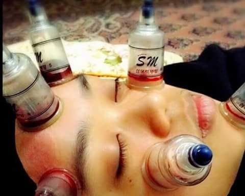 Photo of Alshifa Hijama wetcupping center Andheri powai sakinaka marol Asalfa kherani road