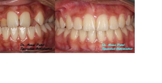 Photo of Avani Patel Orthodontics